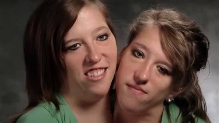 Abby, Brittany Hensel Today TLC Conjoined Twins Now In Touch Weekly