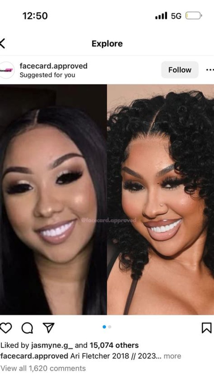 Ari Fletcher Before Surgery Surgical Tech