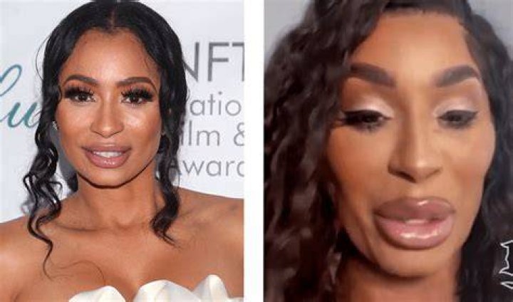 Black America Responds To Karlie Redd&rsquo;s New Look And Trends In Plastic