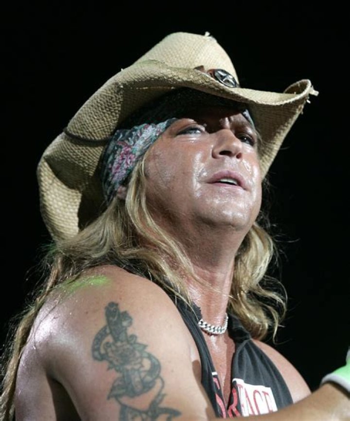 Bret Michaels suffers setback Hyponatremia risk of seizures