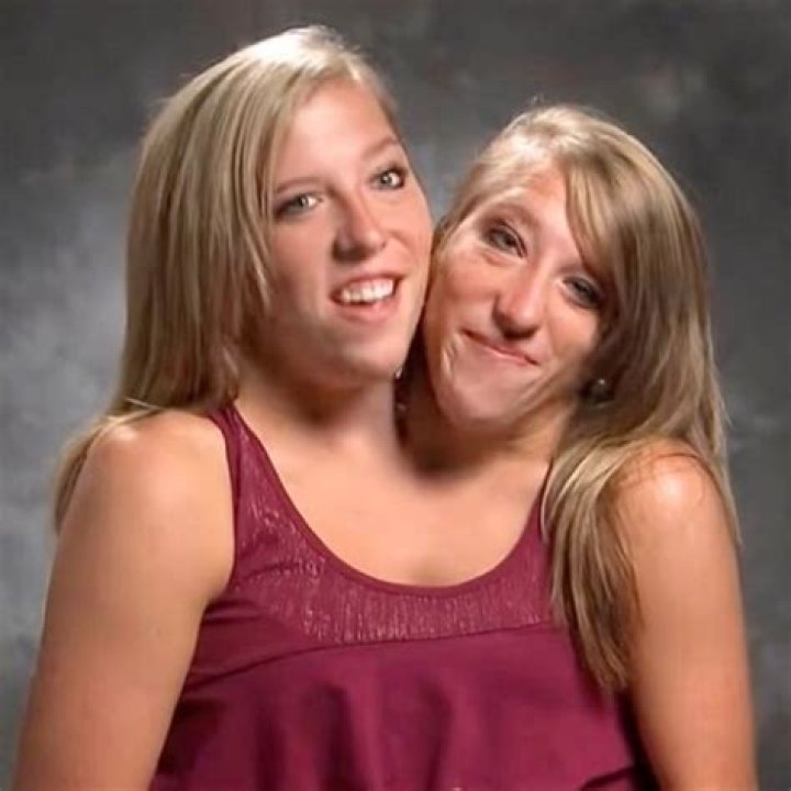 Brittany & Abby Conjoined Twins Major Update! Married & What Else