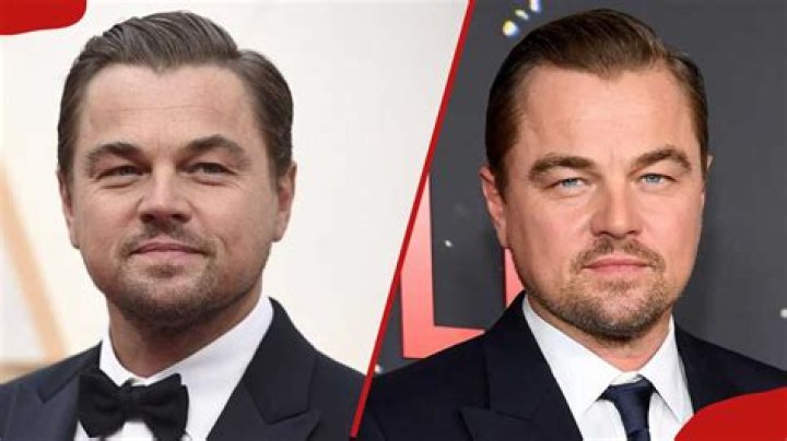 Celebrities With Cleft Lip And Palate