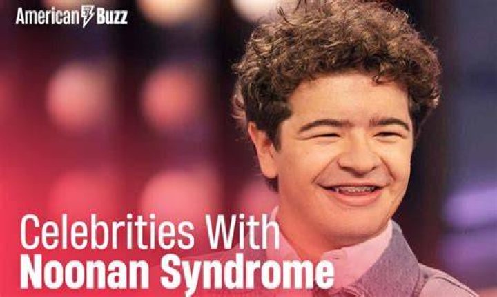 Celebrities with Noonan Syndrome r/GiggleWave