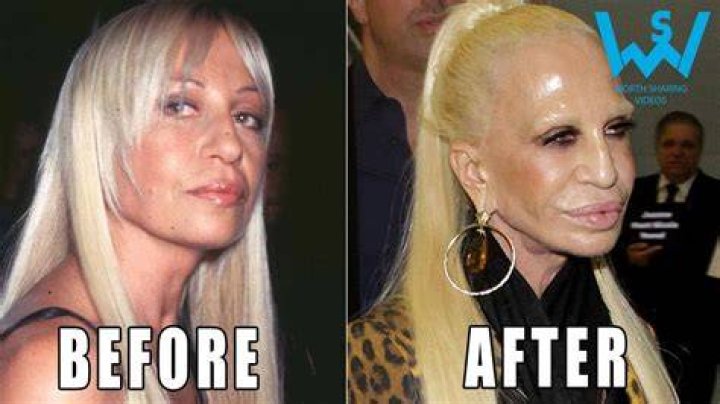 Celebrity plastic surgery disasters Fox News