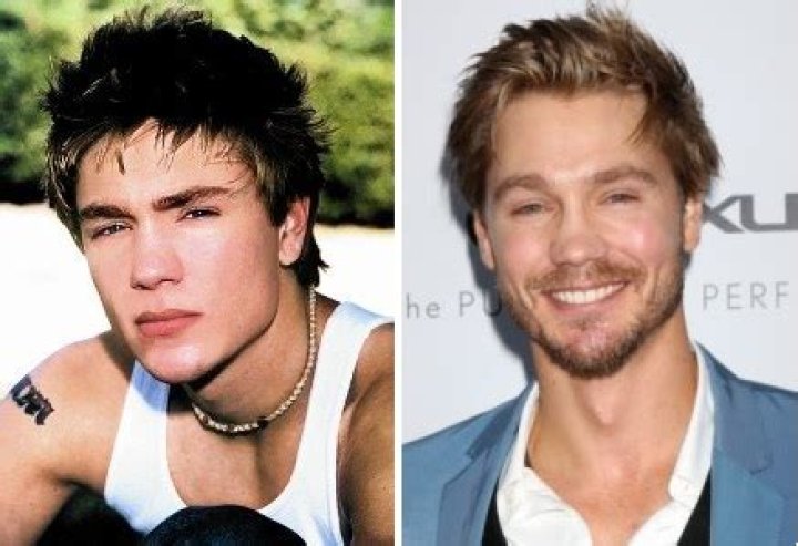 Chad Michael Murray Plastic Surgery Before and After Celebrity Sizes