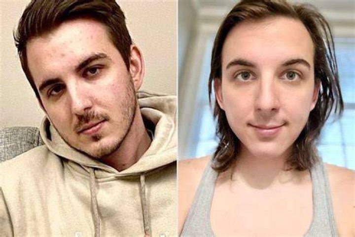 Chris From Mr Beast Transformation Magical Assam