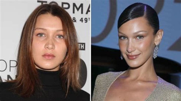 Did Bella Hadid Get a Nose Job? See Before and After Photos of the