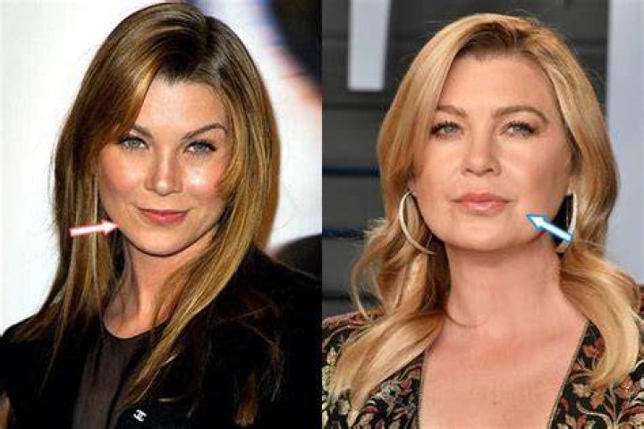 Did Ellen Pompeo Get Plastic Surgery? Transformation in Photos Closer