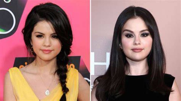 Did Selena Gomez Ever Get Plastic Surgery? Why She Has Sparked Rumors