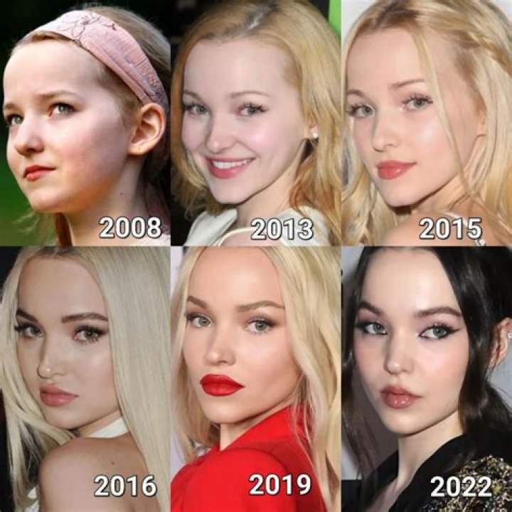 Dove Cameron Before Plastic Surgery Pictures Plastic Surgery Magazine