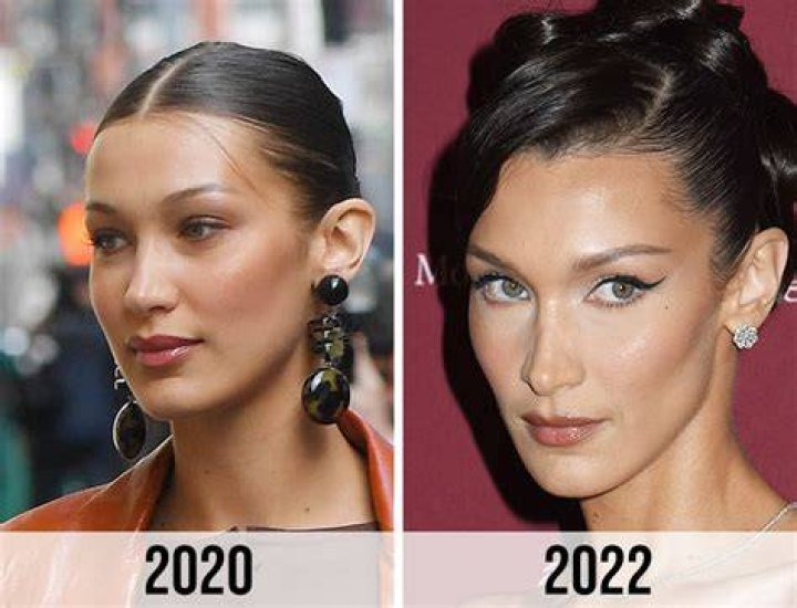 Fans Think Bella Hadid Had Fat Removal Surgery After Seeing Old Pictures
