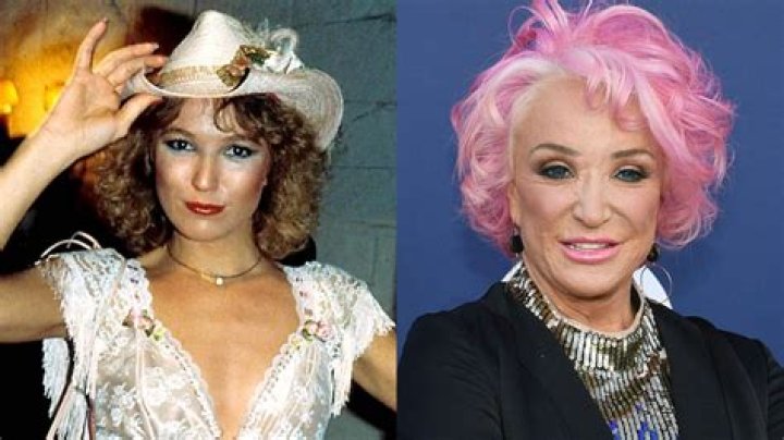 Has Tanya Tucker Had Plastic Surgery? Who is Tanya Tucker? News