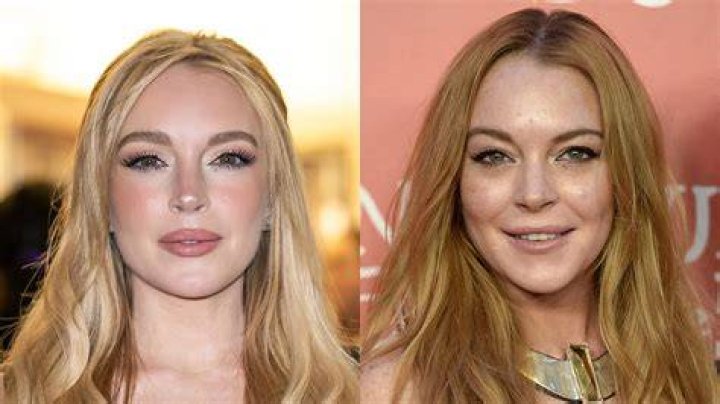 Lindsay Lohan Plastic Surgery Before and After Photo 20132014