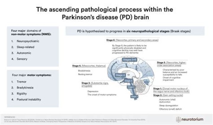 Parkinson disease (PD) What Is It ? How Its Caused