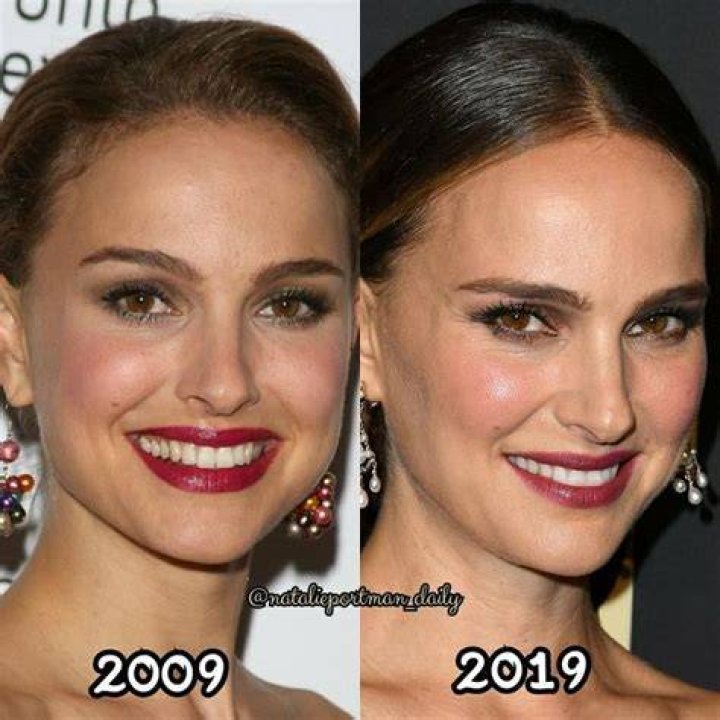 Plastic Surgery? See Natalie Portman's Shocking Transformation Right