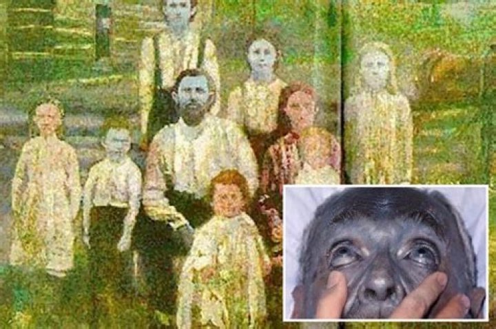 Reallife &lsquo;Avatar&rsquo; blue people existed &mdash; thanks to years of inbreeding