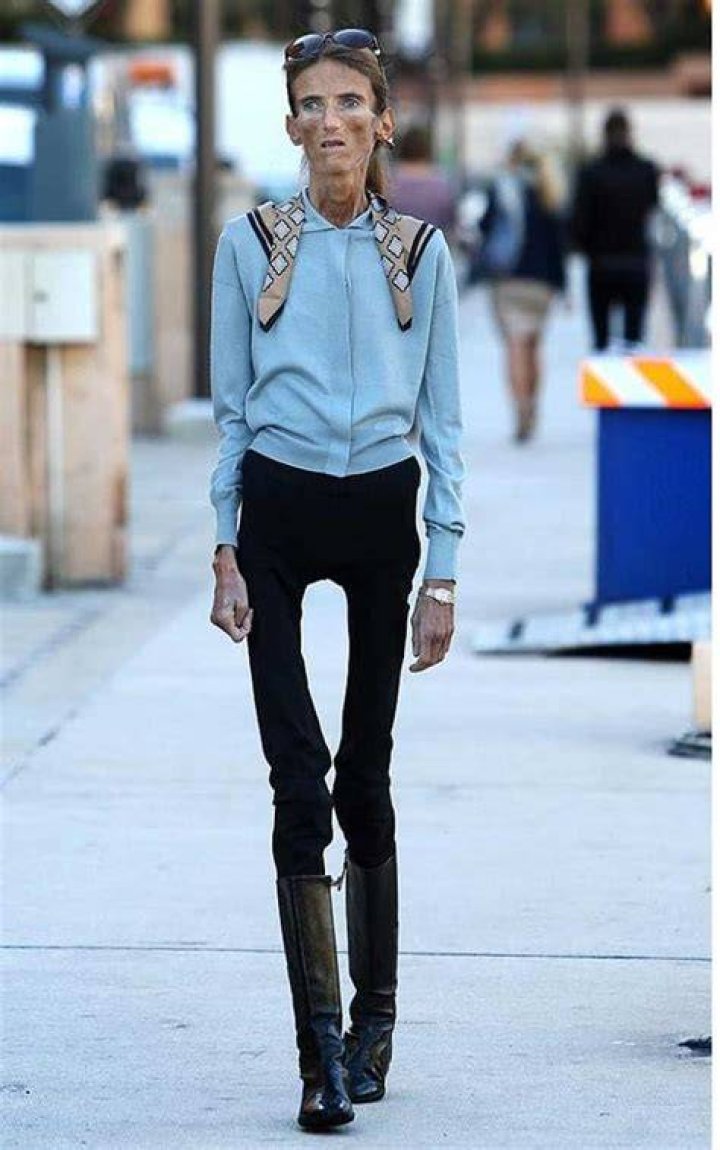 The Skinniest Person In The World (10 Of Them) Fieracad