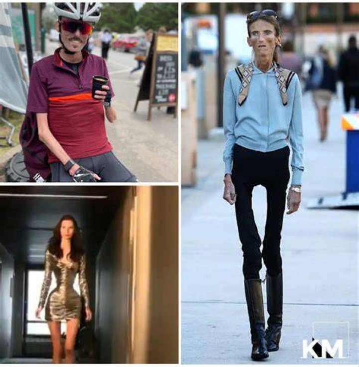 The World Skinniest Man Alive The Most Skinniest Man On Earth Notion.ng
