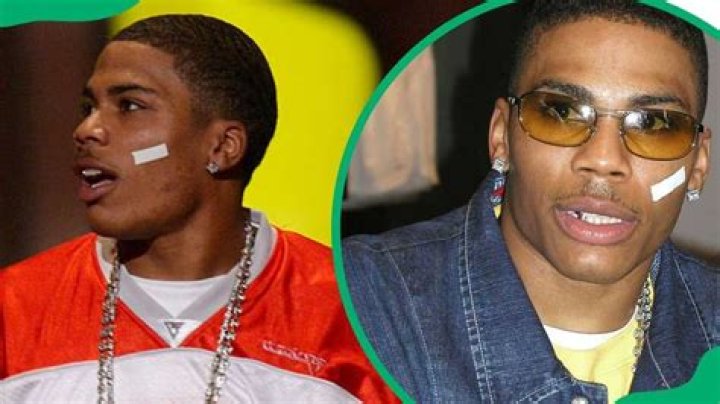 This Is Why Nelly Wore A BandAid On His Face For An Entire Decade