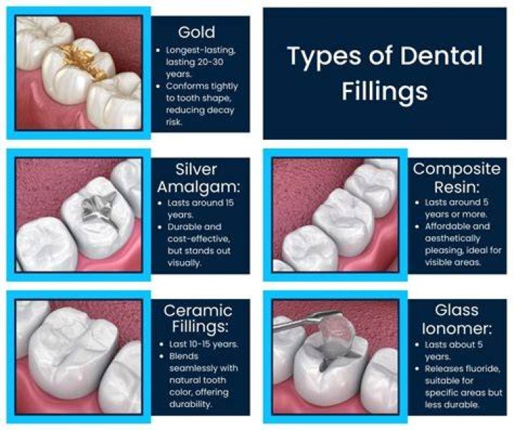What are black fillings made of?