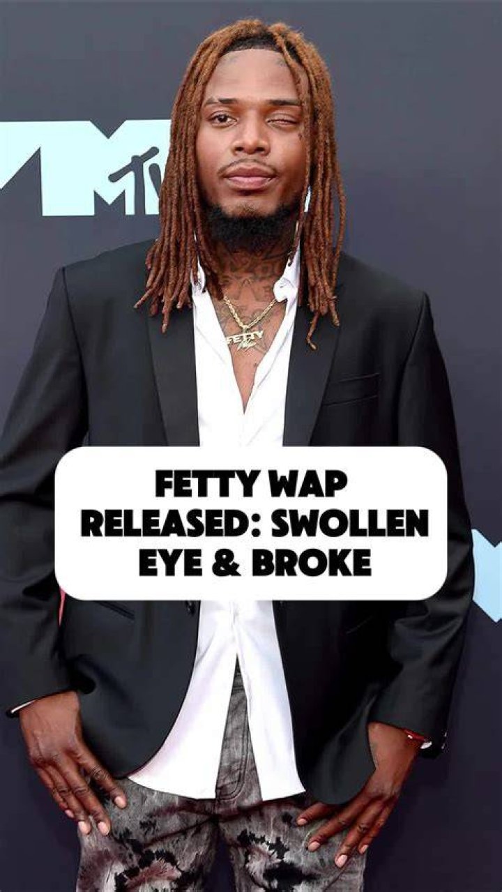 What Happened to Fetty Wap&rsquo;s Eye? HERE'S THE REAL STORY